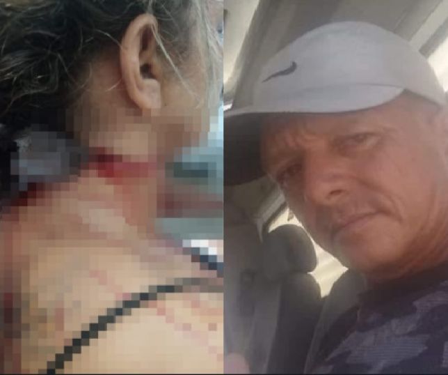 Mulher fica com faca atravessada no pescoço após ser atacada pelo ex-marido