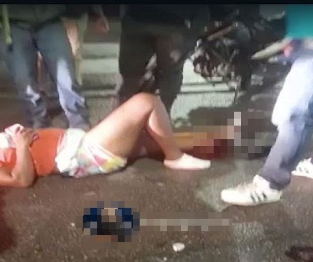 Mulher sofre fratura exposta em uma das pernas após grave acidente com motocicleta no bairro do Planalto